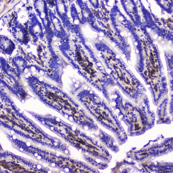 Anti-Talin 1/TLN1 Antibody