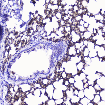 Anti-Talin 1/TLN1 Antibody
