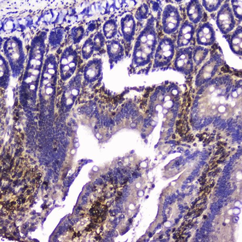 Anti-Talin 1/TLN1 Antibody