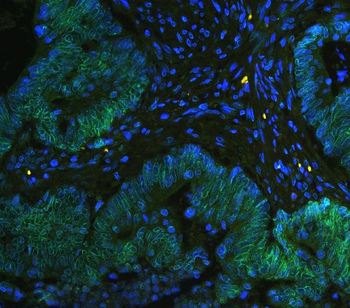 Anti-TPR Antibody