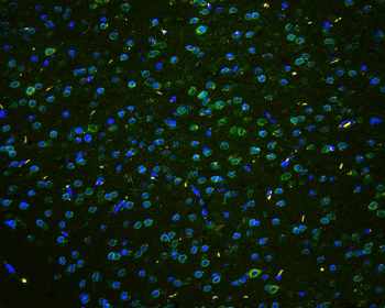 Anti-TPR Antibody