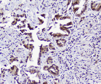 Anti-TPR Antibody