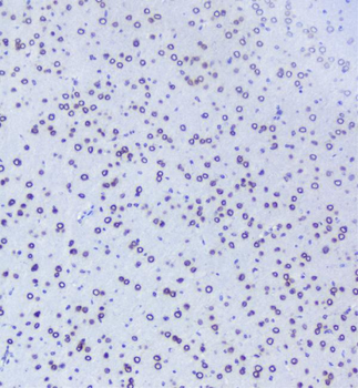 Anti-TPR Antibody