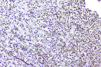 Anti-TPR Antibody