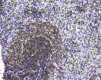 Anti-TPR Antibody