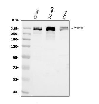 Anti-TPR Antibody
