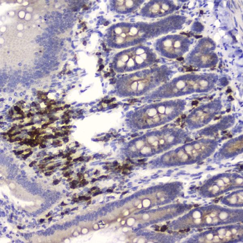 Anti-HE4/WFDC2 Antibody