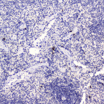 Anti-HE4/WFDC2 Antibody