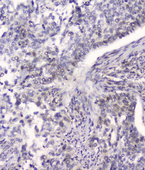 Anti-HSPA2 Antibody (monoclonal, 4A4)
