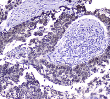 Anti-Hsp70 HSPA1A Antibody (monoclonal, 3H5)