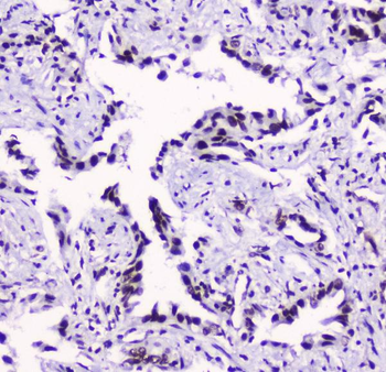 SMC3 Antibody (monoclonal, 4C12)