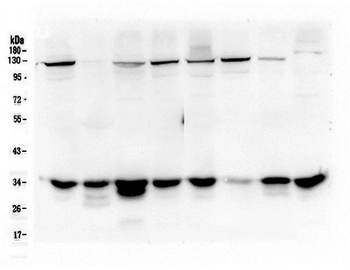 Anti-AMPK beta 2 PRKAB2 Antibody (monoclonal, 6G1)