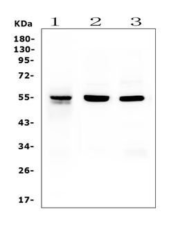 Anti-RbAp48 RBBP4 Antibody (monoclonal, 9F3)