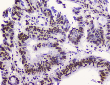 Anti-RbAp48 RBBP4 Antibody (monoclonal, 9F3)