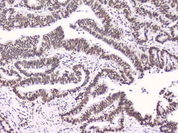 Anti-RbAp48 RBBP4 Antibody (monoclonal, 9F3)