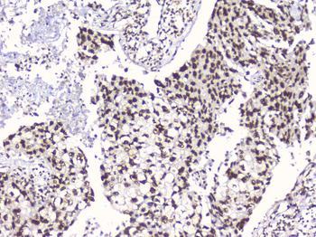 Anti-RbAp48 RBBP4 Antibody (monoclonal, 9F3)