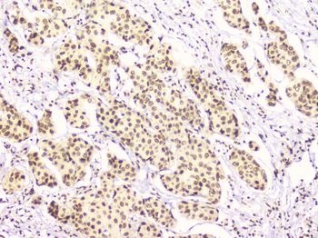 Anti-RbAp48 RBBP4 Antibody (monoclonal, 9F3)