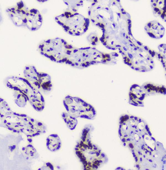 Anti-RbAp48 RBBP4 Antibody (monoclonal, 9F3)