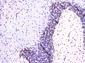 Anti-RbAp48 RBBP4 Antibody (monoclonal, 9F3)