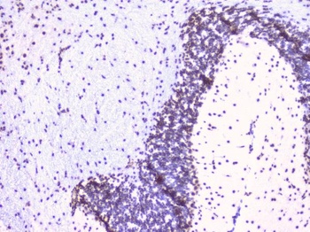 RbAp48 RBBP4 Antibody (monoclonal, 9F3)