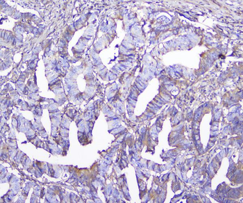 Anti-GSTM1 Antibody (monoclonal, 11F2)
