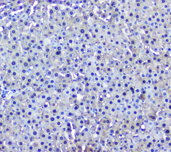 Anti-GSTM1 Antibody (monoclonal, 11F2)