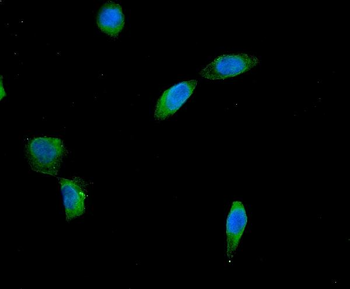 AES Antibody