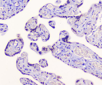 AES Antibody