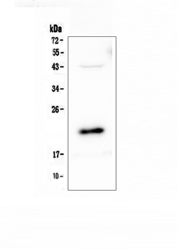AES Antibody