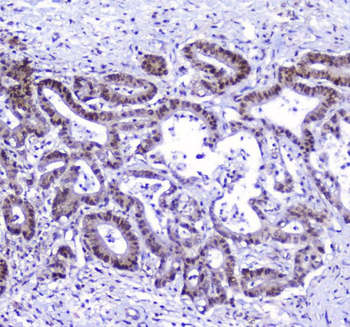 Anti-AHR Antibody