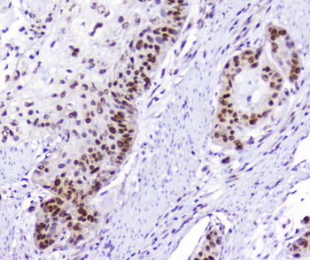 Anti-AHR Antibody