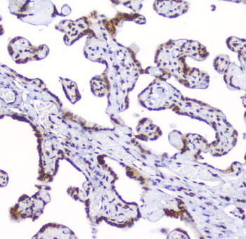 Anti-AHR Antibody