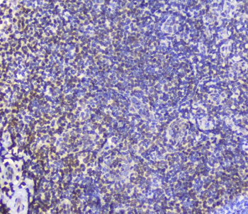 Anti-AHR Antibody