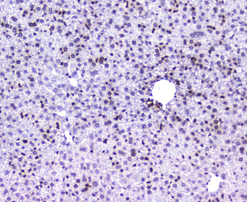 Anti-AHR Antibody
