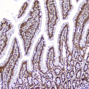 Anti-AHR Antibody