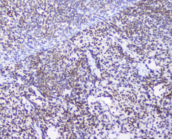 Anti-AHR Antibody