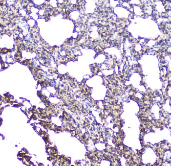 Anti-Aquaporin 5/AQP5 Antibody
