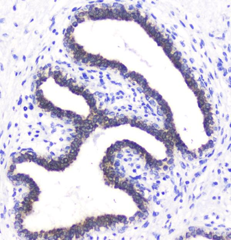 BTC Antibody