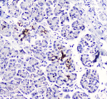 Anti-BTC Antibody