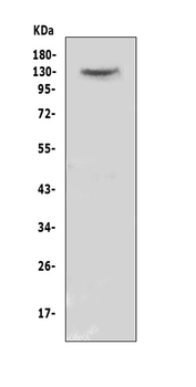 Anti-CACNA2D2 Antibody