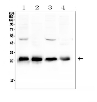 Calbindin/CALB1 Antibody