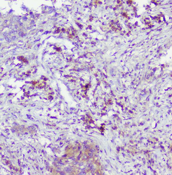 Anti-Caspase-2/CASP2 Antibody