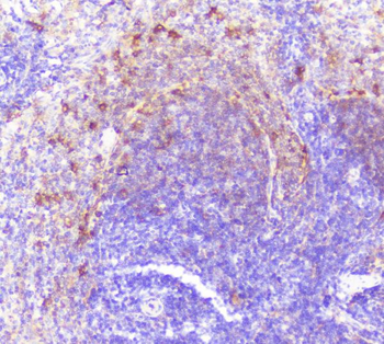 Anti-Caspase-2/CASP2 Antibody