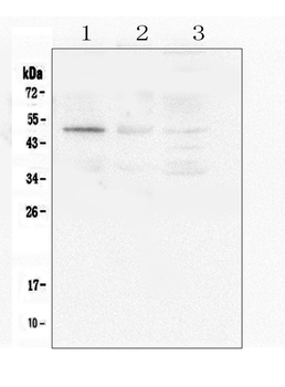 Anti-Caspase-2/CASP2 Antibody