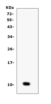 Anti-CCL6 Antibody