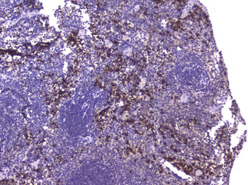 Anti-CCL8 Antibody