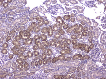 Anti-CCL8 Antibody