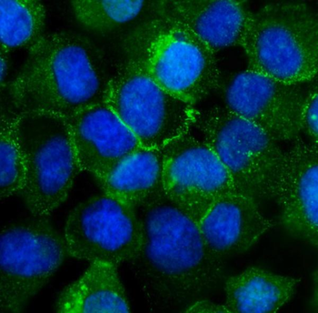 P-Cadherin-3 CDH3-/CDH3 Rabbit Polyclonal Antibody