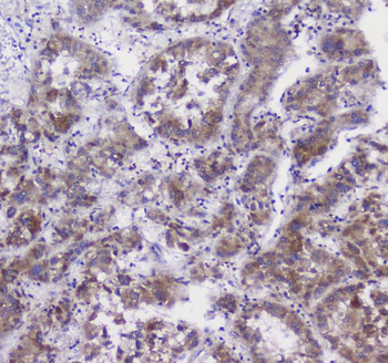 Anti-CFP Antibody
