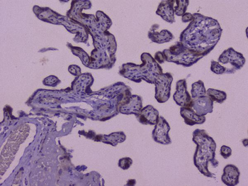 Anti-CIC Antibody